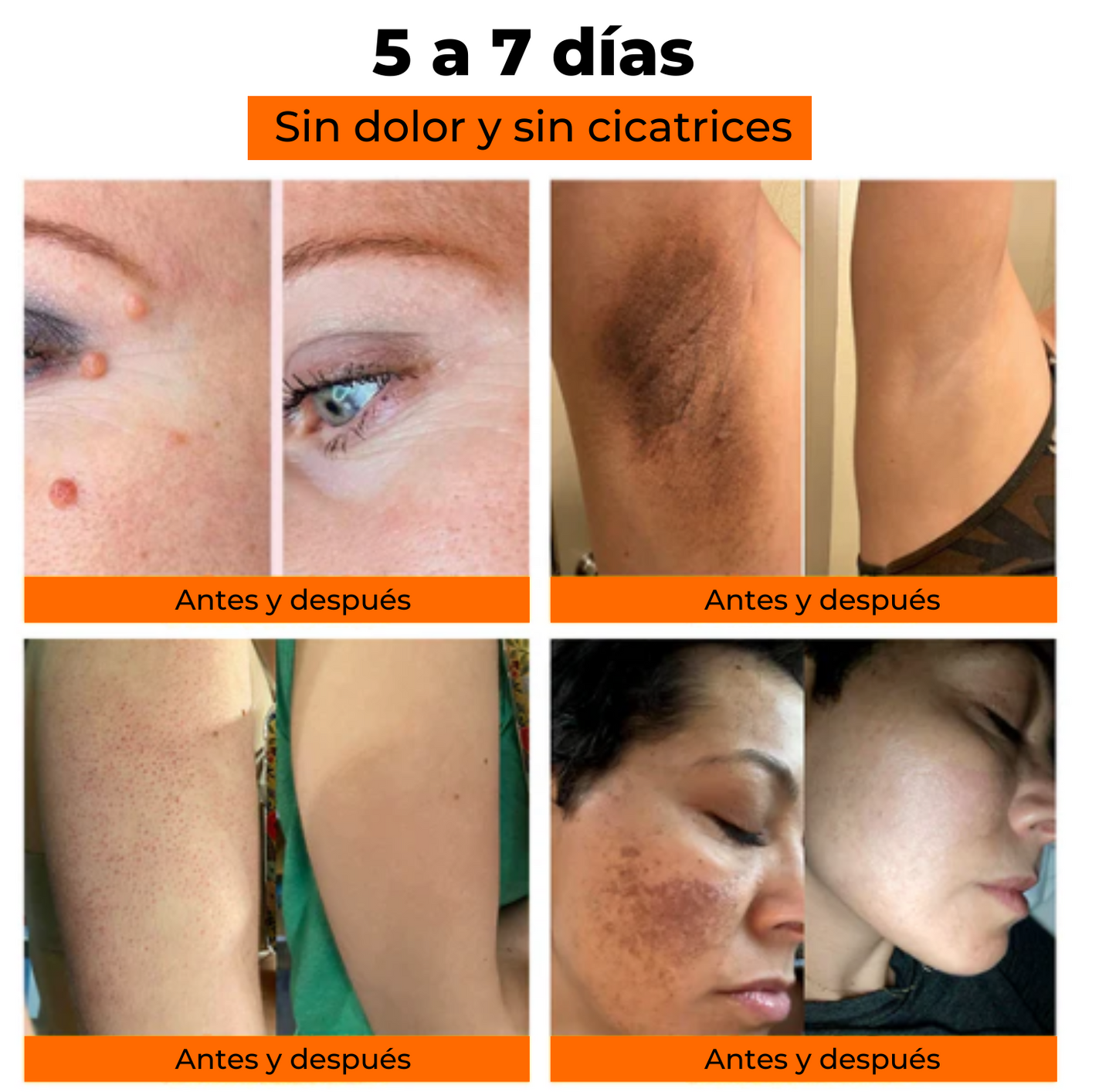 Crema para Articulacion y Berrugas Veneno de Abejas