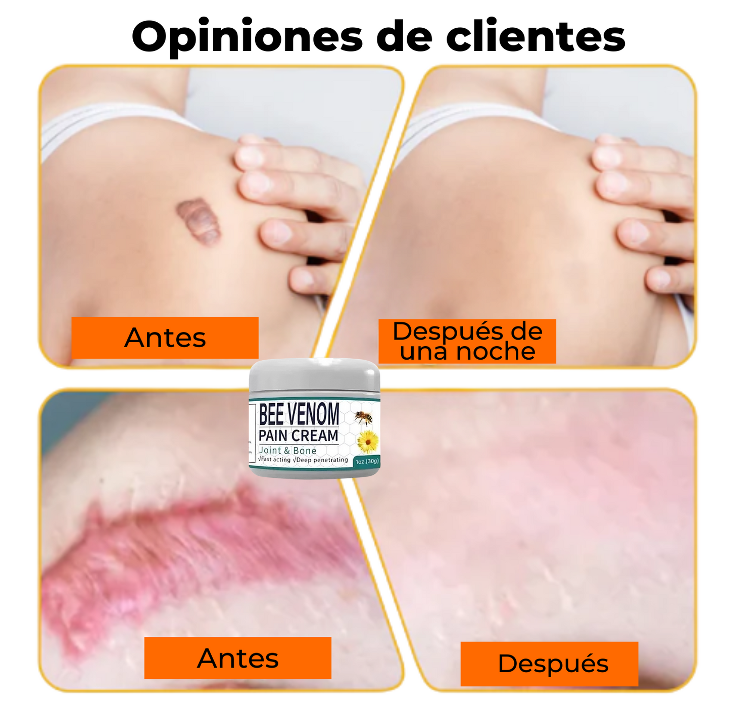 Crema para Articulacion y Berrugas Veneno de Abejas