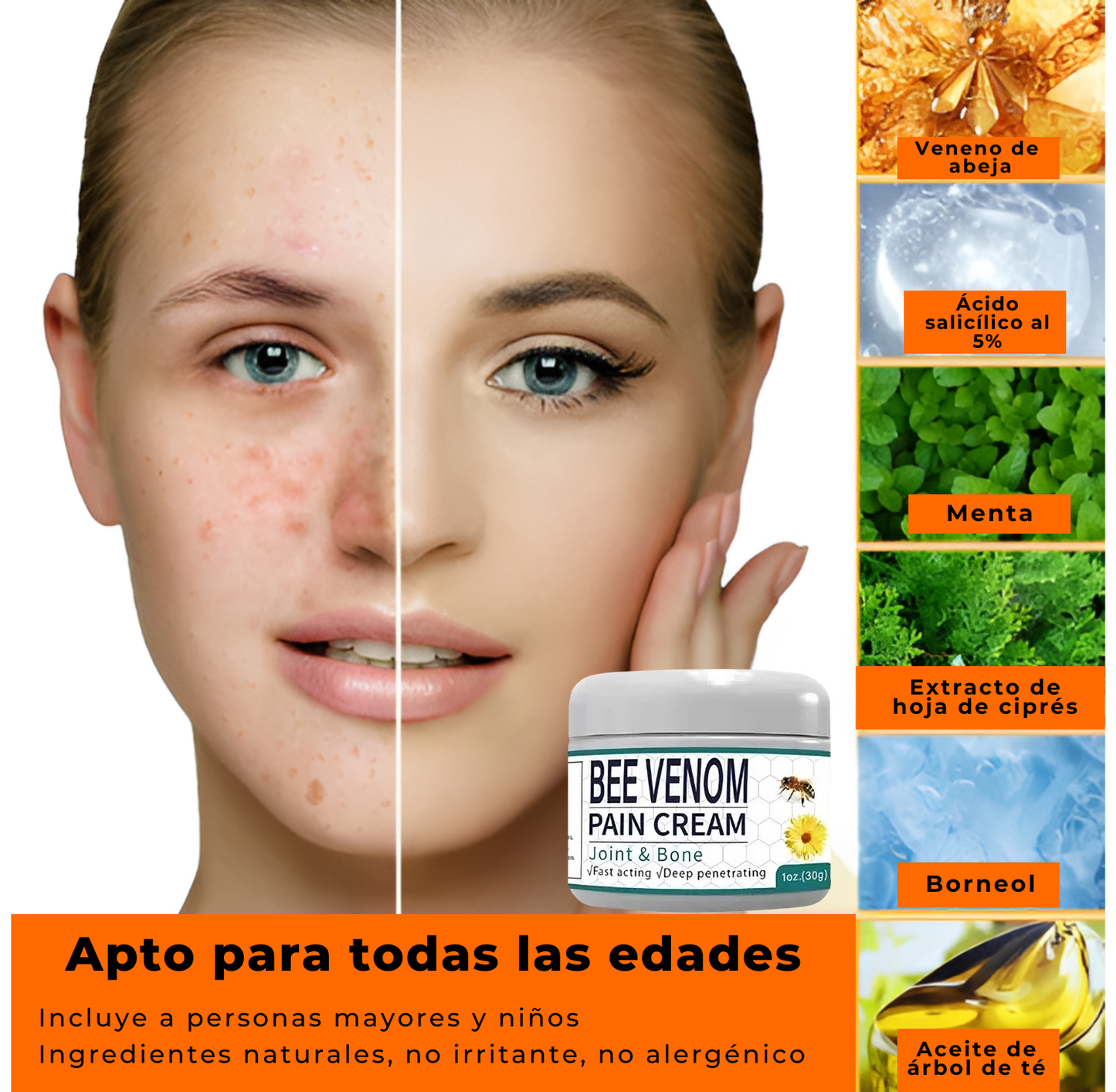 Crema para Articulacion y Berrugas Veneno de Abejas